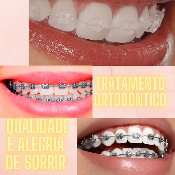 Foto 3 de Clínica Odontológica : Estética Dentes Guapira