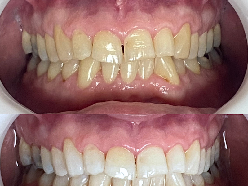 Foto 10 de Clinica odontológica | Harmonização facial - Invisalign - Implantes dentários | Odontobet