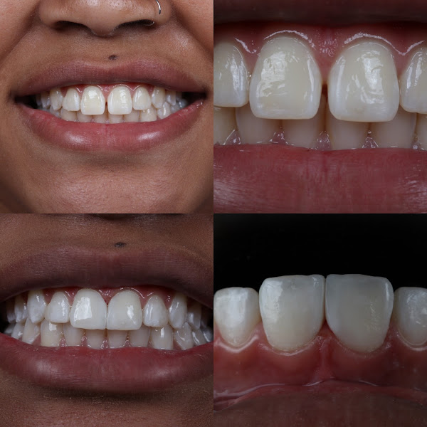 Foto 2 de Clínica Odontológica Intra-Oral