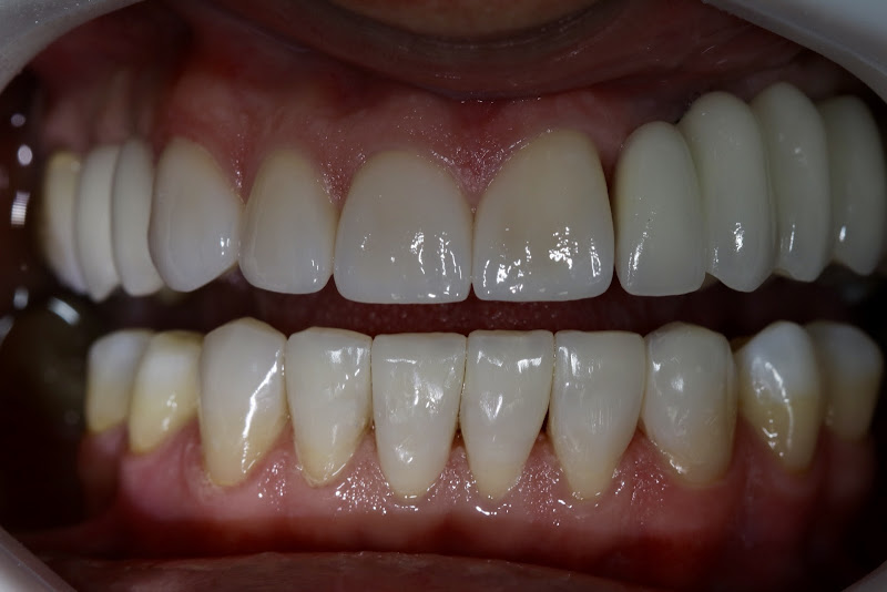 Foto 3 de Clínica Odontológica Intra-Oral