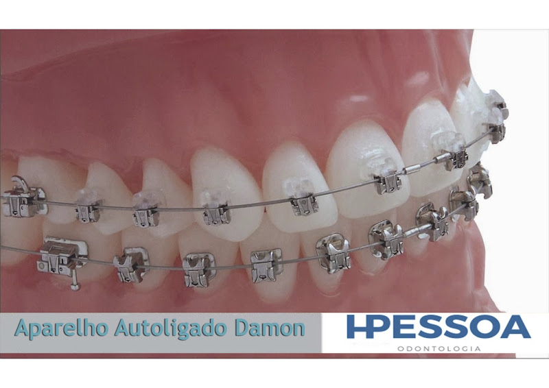 Foto 3 de Clinica Odontologica Ipiranga HPessoa Odontologia