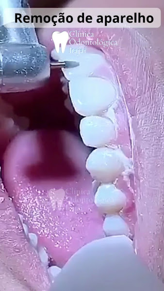 Foto 4 de Clínica Odontológica Itajaí | Centro