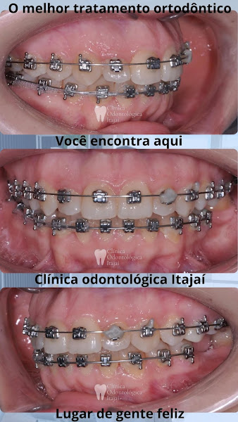 Foto 5 de Clínica Odontológica Itajaí | Centro