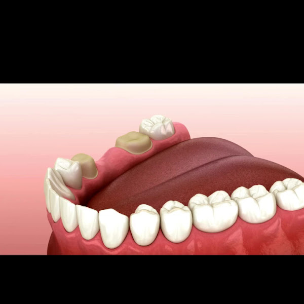 Foto 4 de Clínica Odontológica LAVID