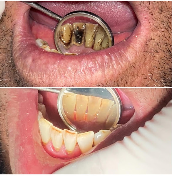 Foto 2 de Clínica Odontológica Mega White