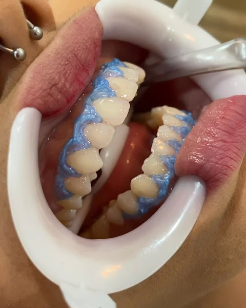 Foto 4 de Clínica Odontológica Meirielle Azevedo