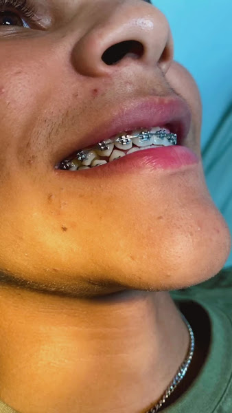 Foto 3 de Clínica Odontológica NEOCENTER- Drº Arilson Silva Pereira