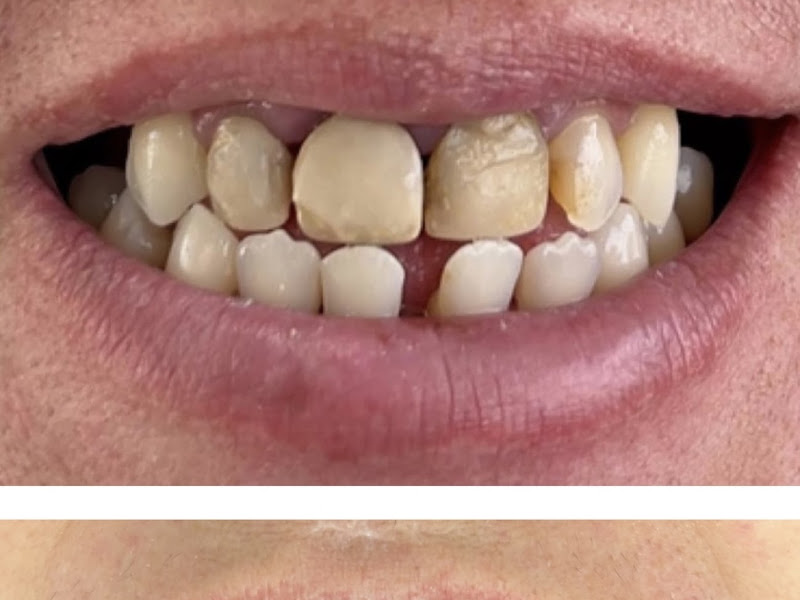 Foto 8 de Clínica Odontológica no Brooklin - Wlader Fedozzi