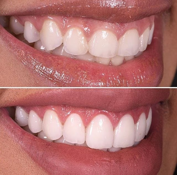 Foto 3 de Clínica Odontológica. Odonto Ferreira