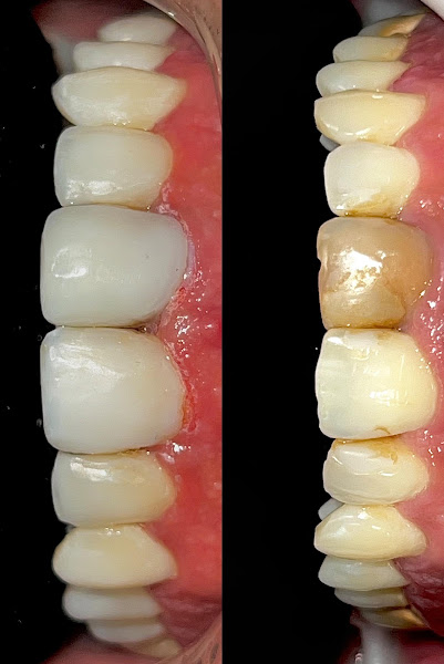 Foto 3 de Clínica Odontológica Odonto Sena - Dentista, Paquetá, Castelo Belo Horizonte