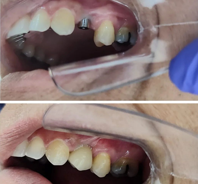 Foto 2 de Clinica Odontológica Odonto Souza