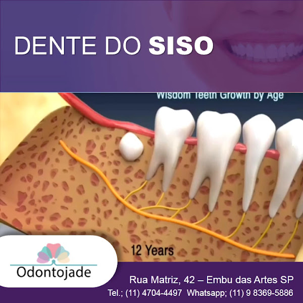 Foto 3 de Clinica Odontológica Odontojade -Implantes dentarios, Odontopediatria, Ortodontia, Tratamento de canal - Embu das Artes - SP