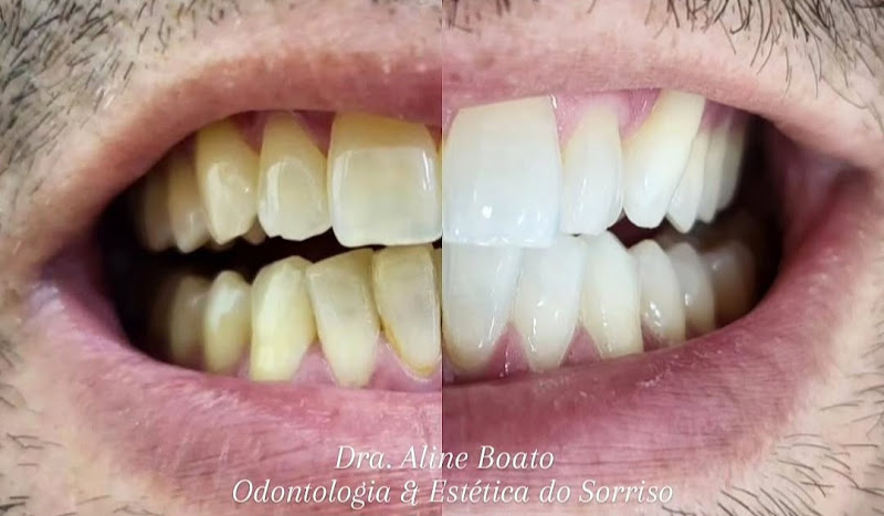 Foto 2 de Clínica Odontológica Odontoline - Dra. Aline Boato