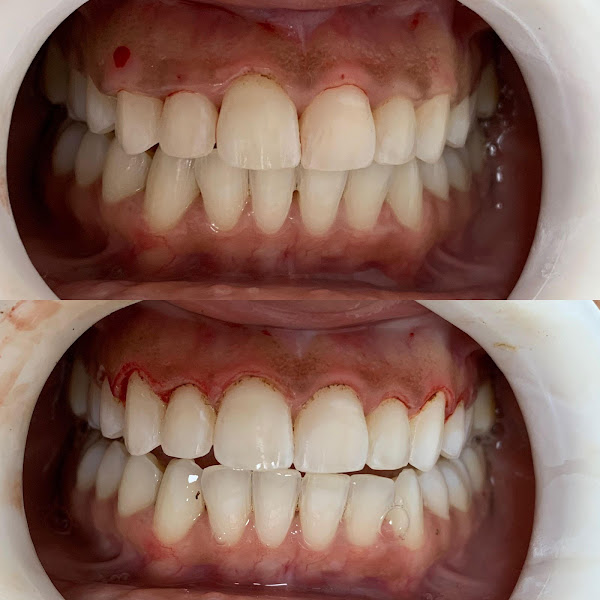 Foto 2 de Clínica Odontológica OdontoVan