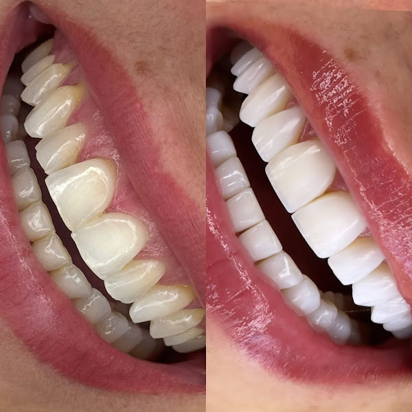 Foto 2 de Clínica Odontológica Ômega