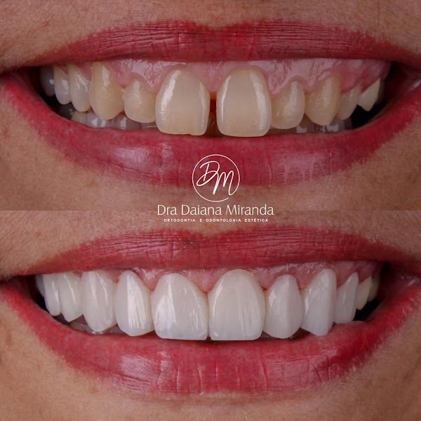 Foto 5 de Clínica Odontológica Orto Prime Estética