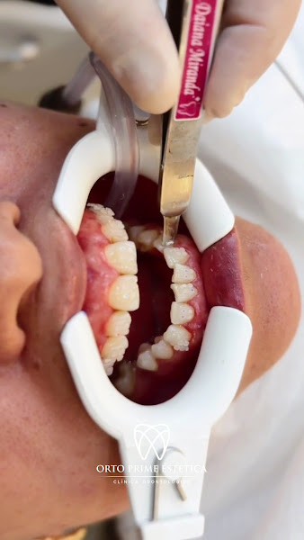 Foto 6 de Clínica Odontológica Orto Prime Estética