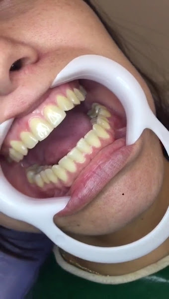 Foto 3 de Clinica Odontológica Paceli l Dentista em Barreiro Minas Gerais