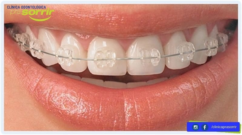 Foto 3 de Clínica Odontológica Pra Sorrir