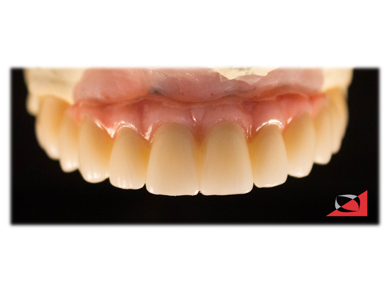 Foto 13 de Clínica Odontológica | Prieto & Prieto | Dr. Lucas Prieto & Dra. Andréa Steilein