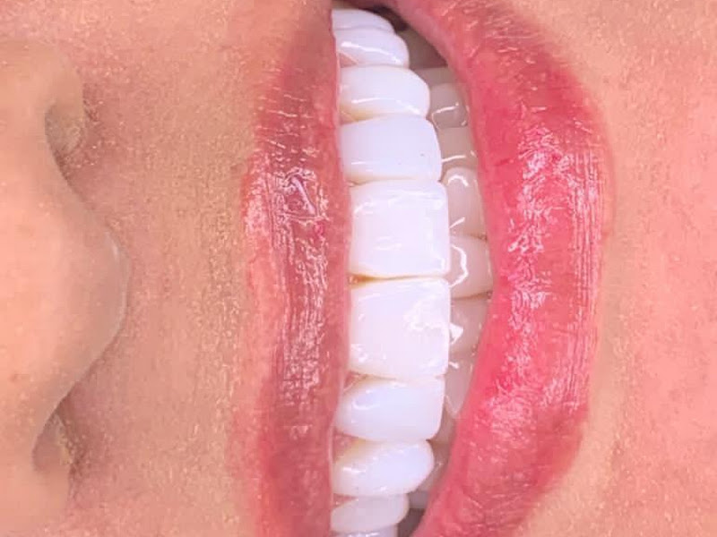 Foto 7 de Clínica Odontológica PrimeImplan