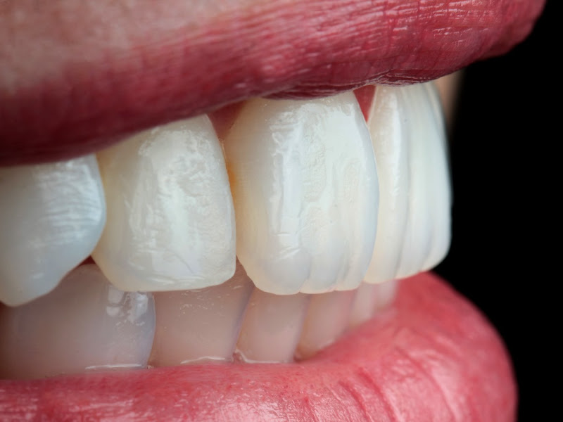 Foto 10 de Clínica Odontológica - QUALIDENT