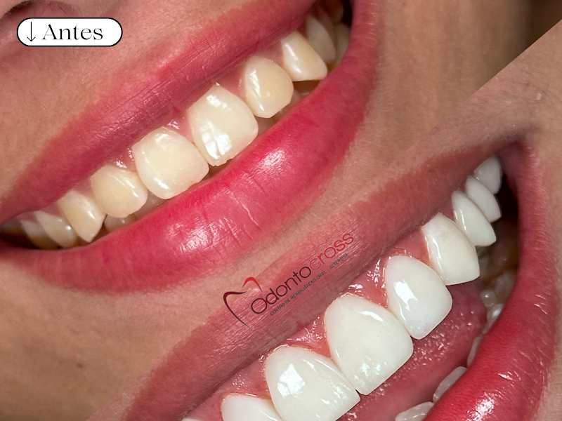 Foto 5 de Clínica Odontológica | Rede Odonto Alterosa