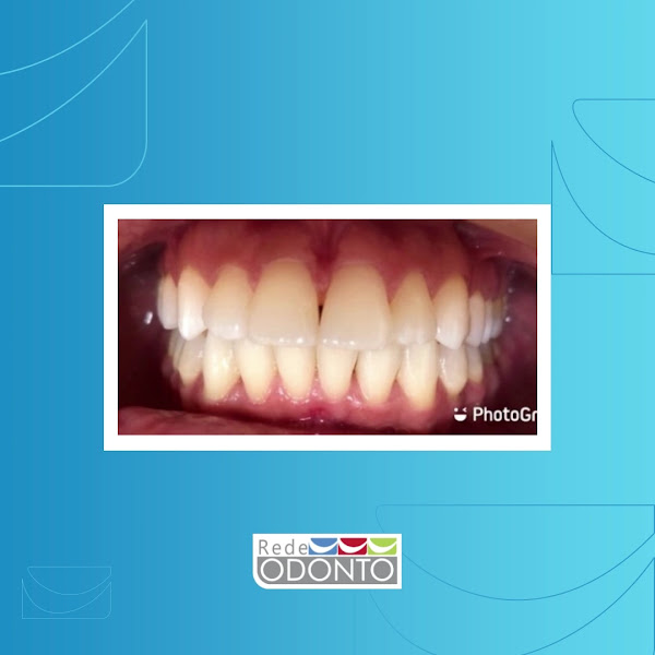 Foto 3 de Clínica Odontológica | Rede Odonto Cariacica