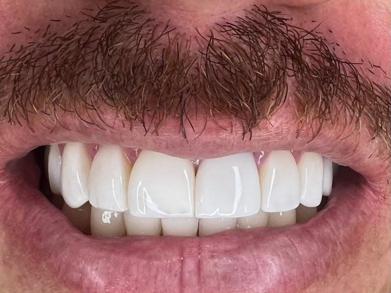 Foto 10 de Clínica Odontológica | Rede Odonto Santa Inês