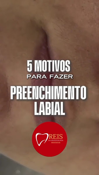 Foto 4 de Clínica odontologica - Reis da odontologia / Dentista em Carapicuiba