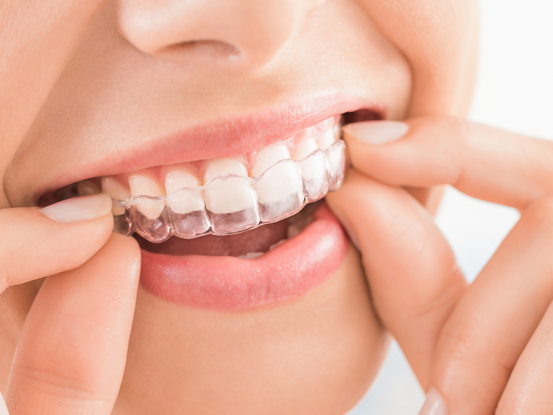 Foto de Clínica Odontológica Roberta Queiroz | Dentista Céu Azul BH