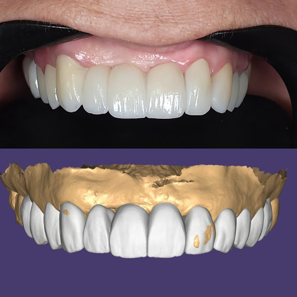 Foto 2 de Clinica Odontológica. RVS Odontologia. Rogner V Schiavon, IMPLANTODONTIA