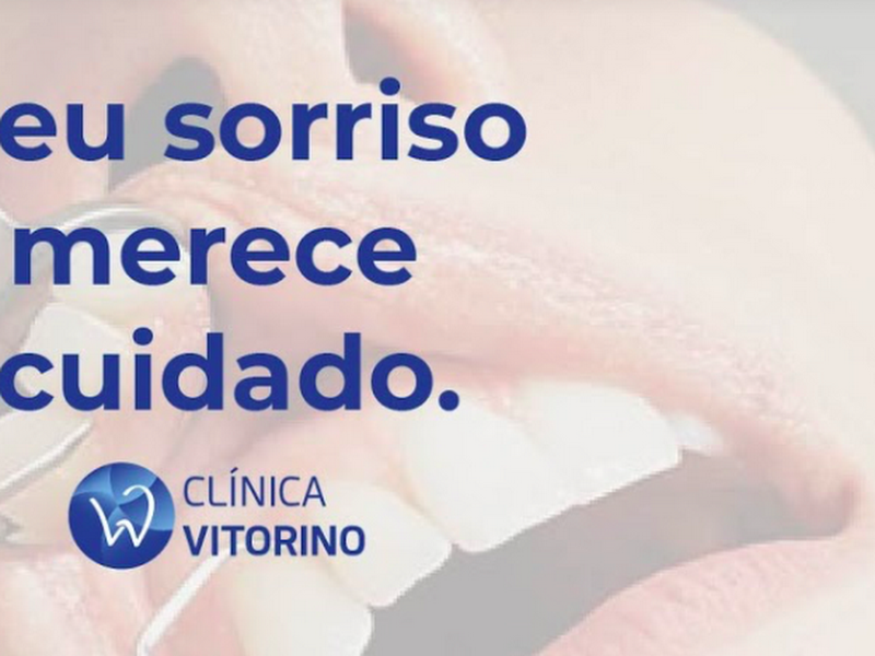 Foto 3 de Clínica Odontológica Santo Antônio | Dentista em Guaratinguetá | Implantes dentários | Aparelho Invisível | SouSmile