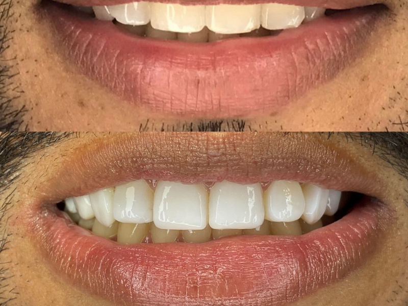 Foto 4 de Clínica Odontológica Smile - Anderson Braga