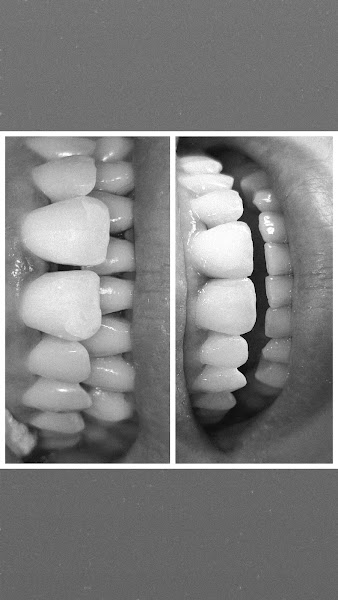 Foto 3 de Clínica Odontológica Socorro São Paulo-SP DR. THIERRY RIBEIRO