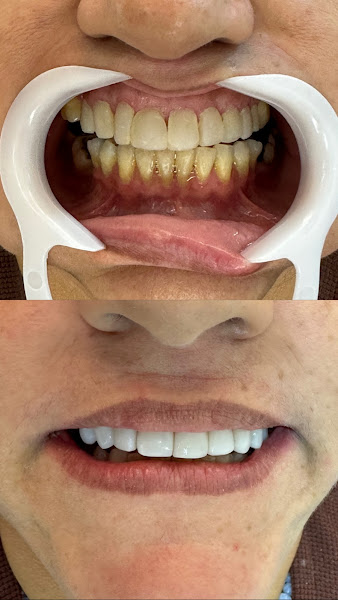 Foto 3 de Clínica odontológica Sorria Leste- Barra do Ceará