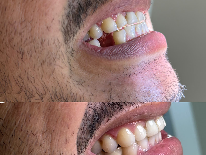 Foto 5 de Clínica odontológica Sorria Leste- Barra do Ceará