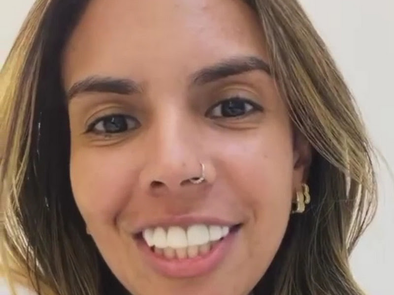 Foto 8 de Clínica odontológica Sorria Leste- Barra do Ceará