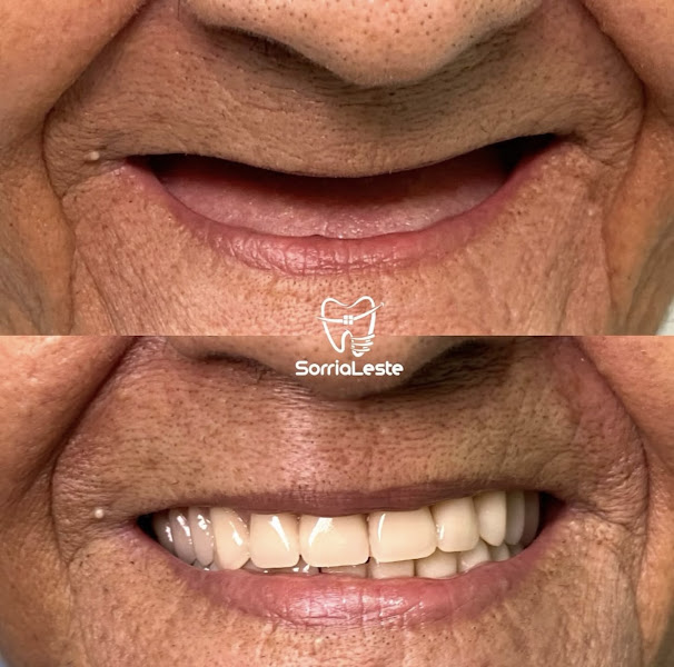 Foto 2 de Clínica odontológica Sorria Leste - Vila União