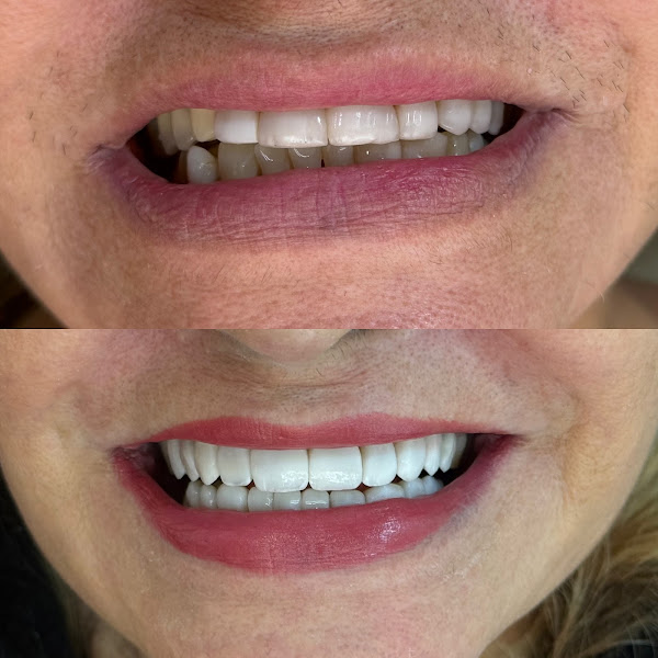 Foto 3 de Clínica odontológica Sorria Leste - Vila União