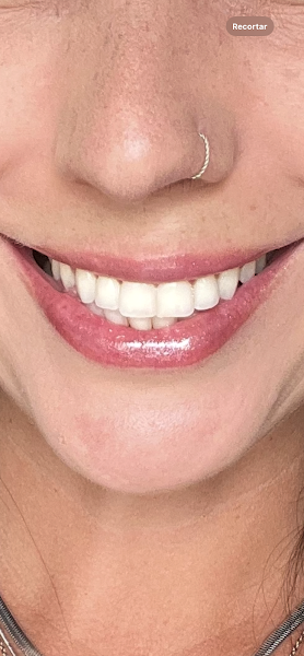 Foto 3 de Clinica Odontológica Sorriso é Vida | Odontopediatria | Canal | Prótese | Implante Dental | Jardim São Luis - SP