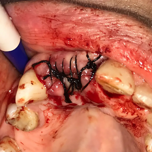 Foto 2 de CLINICA ODONTOLÓGICA Sorriso Vital Implantes