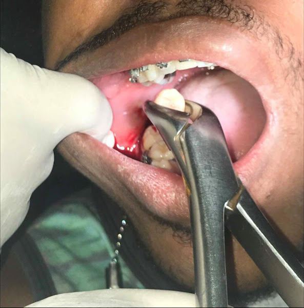 Foto 3 de CLINICA ODONTOLÓGICA Sorriso Vital Implantes