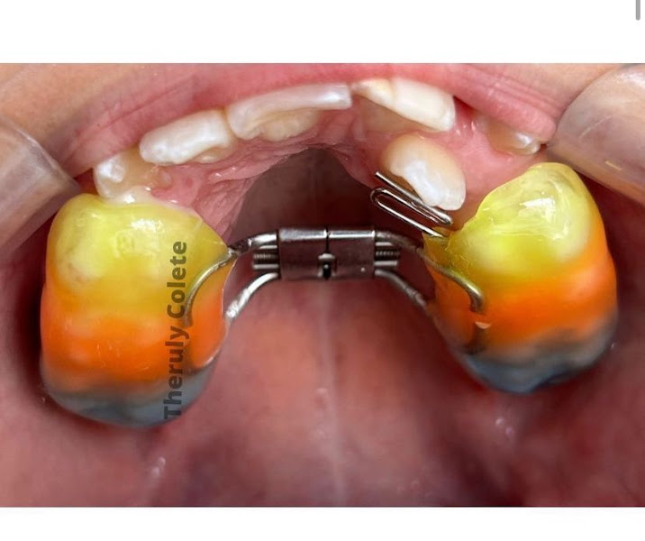 Foto 3 de Clinica Odontológica Total Sorriso | Narandiba