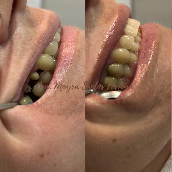 Foto 2 de Clínica Odontólogica VIVA Odonto - Implantes e Cirurgias Orais