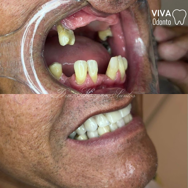 Foto 3 de Clínica Odontólogica VIVA Odonto - Implantes e Cirurgias Orais