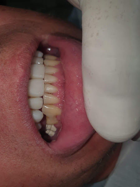 Foto 2 de Clínica Odontoplan