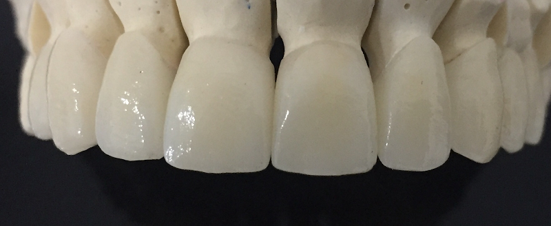 Foto 3 de Clinica ODONTOPLENA Dr. Rafael Favoni Biudes