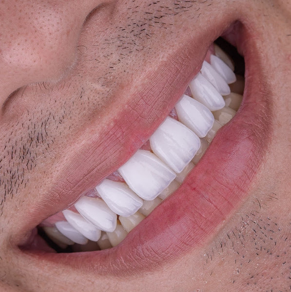 Foto 4 de Clínica OdontoPro