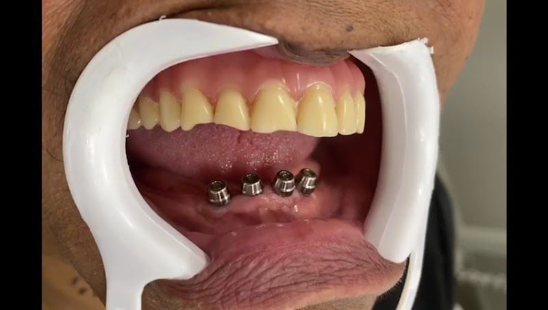 Foto 2 de Clínica Odontoriso